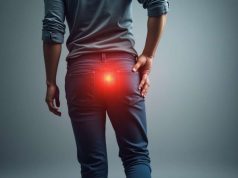 Ciática: causas, síntomas, tratamientos y prevención Ciática: causas, síntomas, tratamientos y prevención